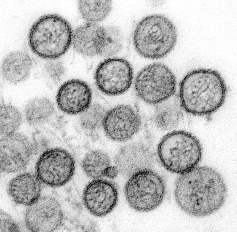 Orthohantavirus microscopie
